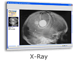 X-Ray